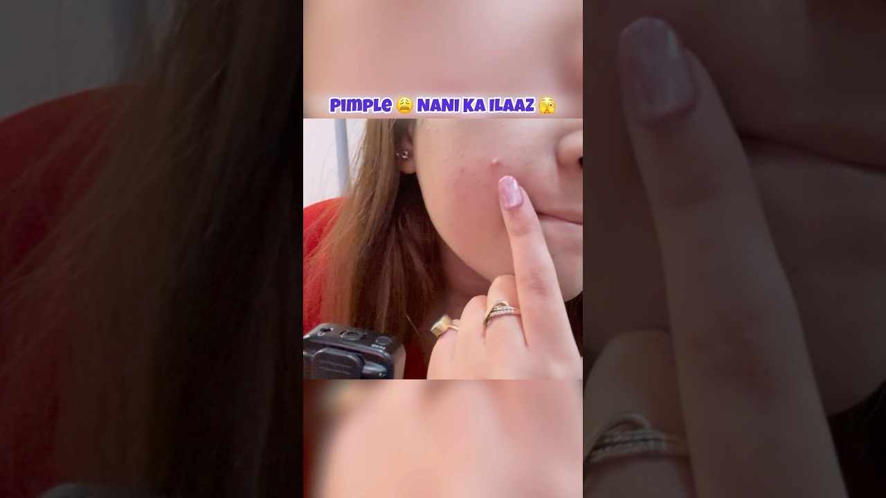 Pimple ka ilaaz nani ne diya 😩❤️ watch full video 🥹 