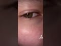 Eye challenge 👀