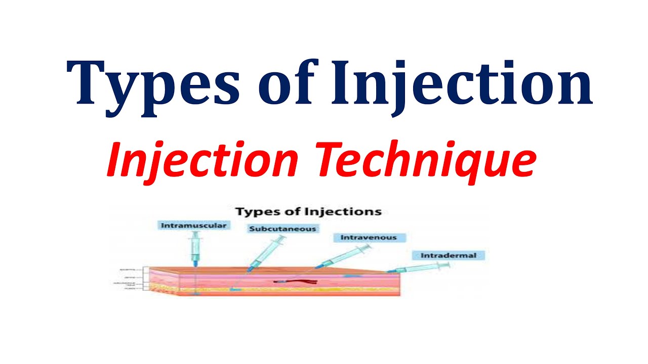 Injection Types