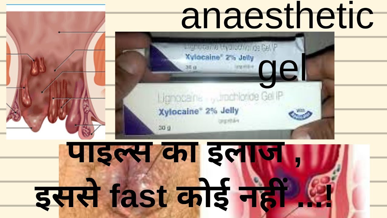 Xylocaine 2 Jelly Full Review In Hindi Youtube