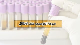 سرعة الترسيب عند الاطفال - اسباب ارتفاع تحليل سرعة الترسيب عند الاطفال