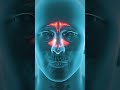 CHI Health Chronic Sinusitis Short #hospital #otolaryngologists #disease