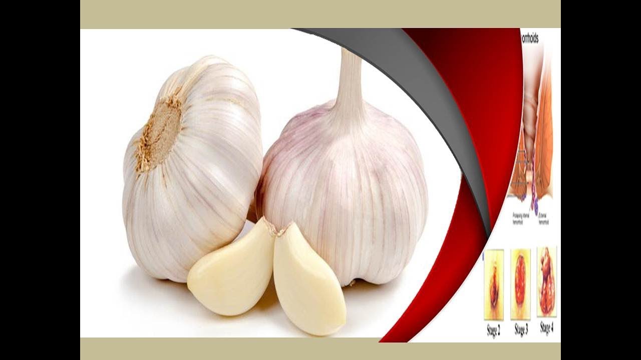 Cara ALAMI Menghilangkan WASIR dengan BAWANG PUTIH YouTube Cara ALAMI Menghilangkan WASIR dengan BAWANG PUTIH YouTube