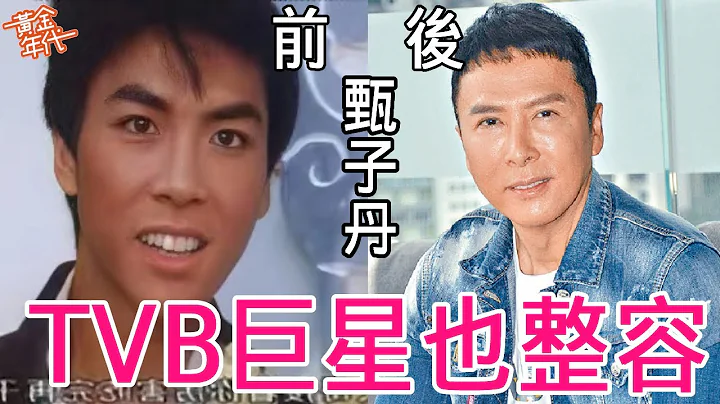 7位TVB巨星整容前后！所有人都割过双眼皮，还有人动过鼻子，太让人意想不到！#古巨基#成龙#甄子丹#张学友#林峯#黄金年代 - 天天要闻