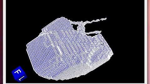 3D liver visualization