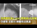 洗頭遭抓傷2.5cm！貴婦收6千和解仍提告　法官斥：揮霍司法資源｜華視新聞 20260520 @CtsTw