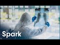 Why Infections Are Getting More Dangerous | Virus VS Bacteria | Spark