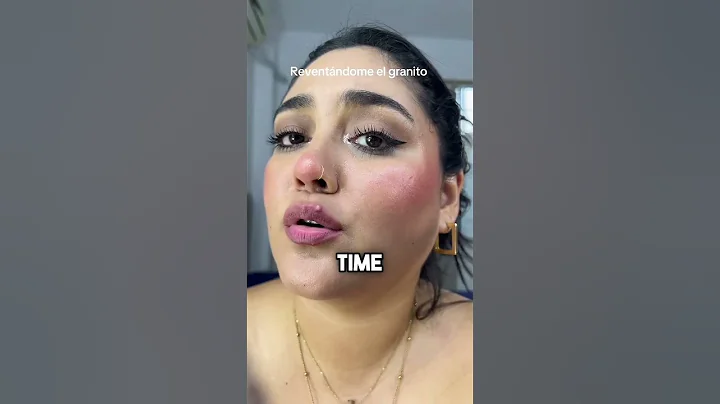 The most painful type of pimple 😱 layslanyherreraso #shorts