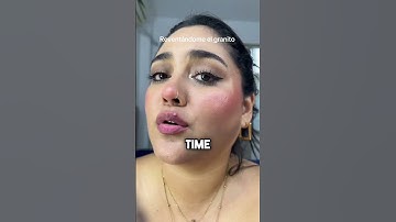 The most painful type of pimple 😱 layslanyherreraso #shorts