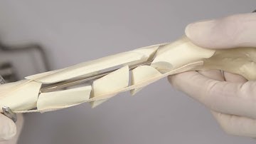 Locking Plate Used in Bridging Mode (Veterinary Instrumentation Orthopaedic Technique Overview)