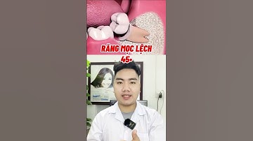 Đừng! Nhổ Răng Khôn Đau Lắm Đấy - răng mọc Lệch 45 độ #rang #nhakhoa #shorts