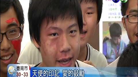 同学我挺你! 百人涂红脸挺胎记生 - 天天要闻