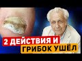 Неумывакин: ЭТОТ ПРОСТОЙ РЕЦЕПТ избавит от ГРИБКА - навсегда!