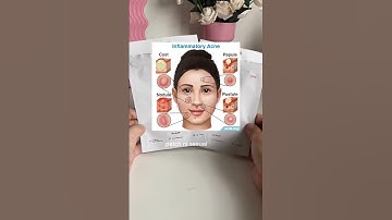 [COSRX OFFICIAL] Acne Pimple Master Patch #ShopeeMY #ShopeeHaul