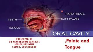 Mouth And Oral Cavity Anatomypalatine Tonsilstongue Anatomydr Akashkusum Banerjeecgmch