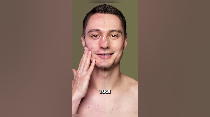 Come Avere una Pelle senza Brufoli e Imperfezioni