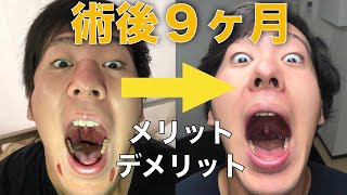 扁桃腺摘出手術 メリット デメリット 術後９ヶ月経過して感じる事 Youtube