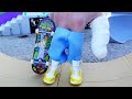 FINGER SKATEBOARD | OMG I GOT INJURED | Wheel Chair Tricks | Tech Deck | Fingerboarding