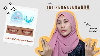 Pengalaman Rapikan Gigi TANPA BEHEL ( review teeth retainer alignment trainer )