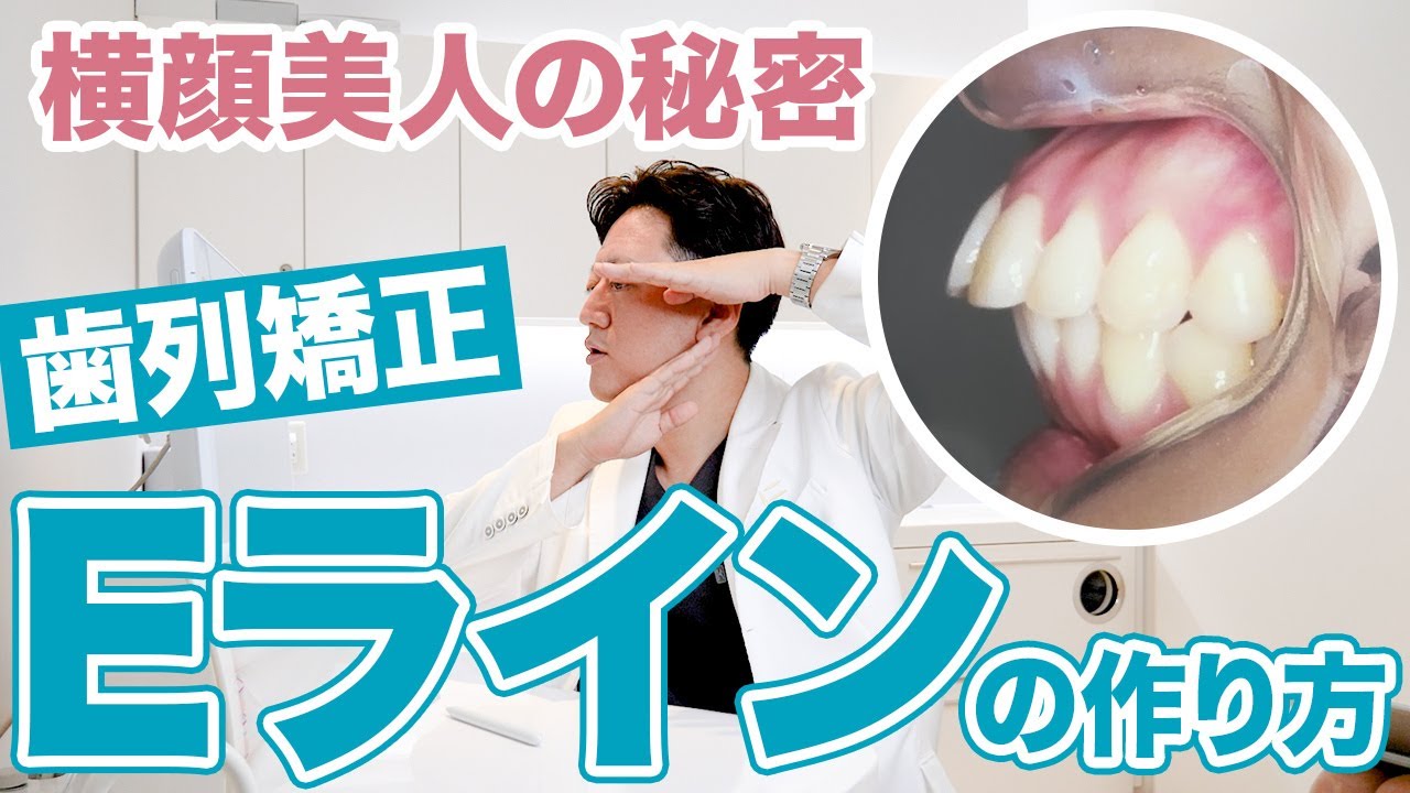 舌側矯正 ◆Dr.Gormanテクニック Correcting protruding mouths! We'll teach you how to create a