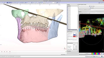 OnyxCeph³™ - All-In-One Orthodontic Imaging Software