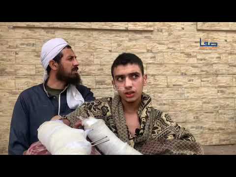 الجريح جهاد راجح بترت ساقه اليسرى ويعاني من جروح بليغة في يديه يطالب بالإسراع في سفره للخارج للعلاج