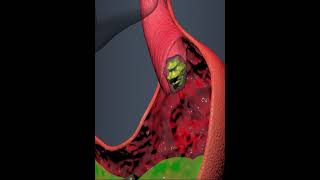 Digestive System- Food Enters In To The Stomach Sphincters Muscles 3D Animation