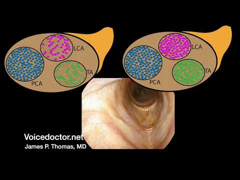 Case study: Lateral cricoarytenoid paresis - an example of a hidden vocal cord paralysis