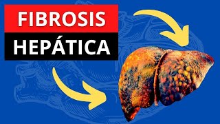 ¿TIENES FIBROSIS HEPÁTICA?: daño silencioso