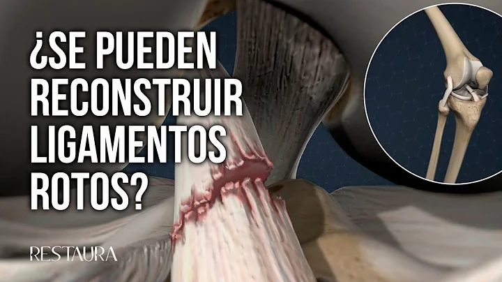 Can torn ligaments be reconstructed?