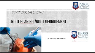 Tutorial video on Root Planing /Root Debridement