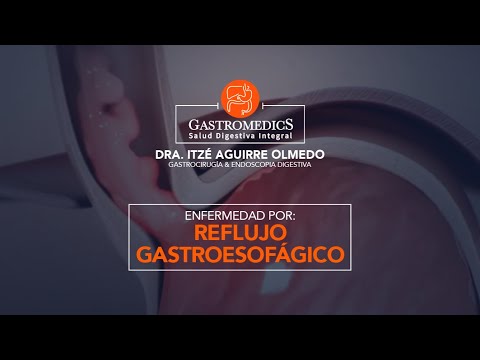 ENFERMEDAD POR REFLUJO
