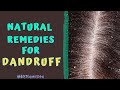 NATURAL HOME REMEDIES FOR DANDRUFF - HOW TO TREAT DANDRUFF AT HOME