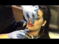 Gentle Micro-Droplet Lip Injections by Clinical Injections Instructor Dr. Naderi