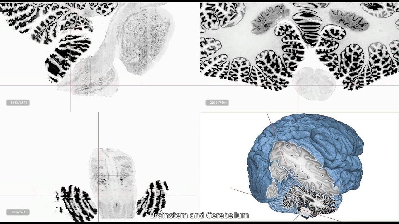 3 слоя мозга. Brain Maps. Human Brain Project Katrin Amunts.