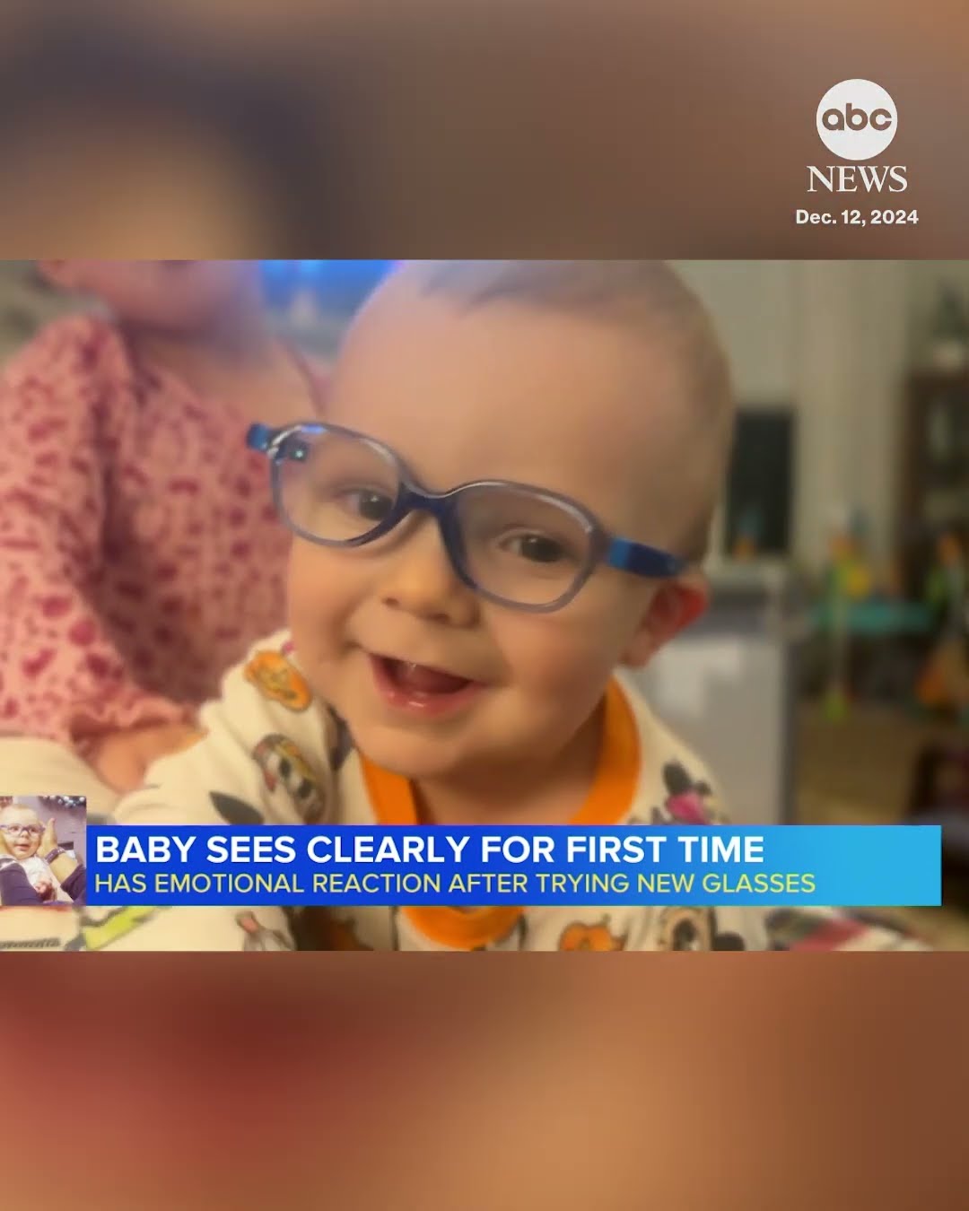 Baby sees clearly for the first time