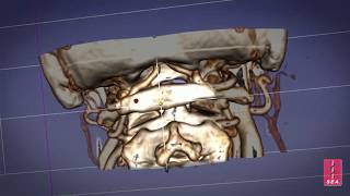CT Data to 3D Print Workflow