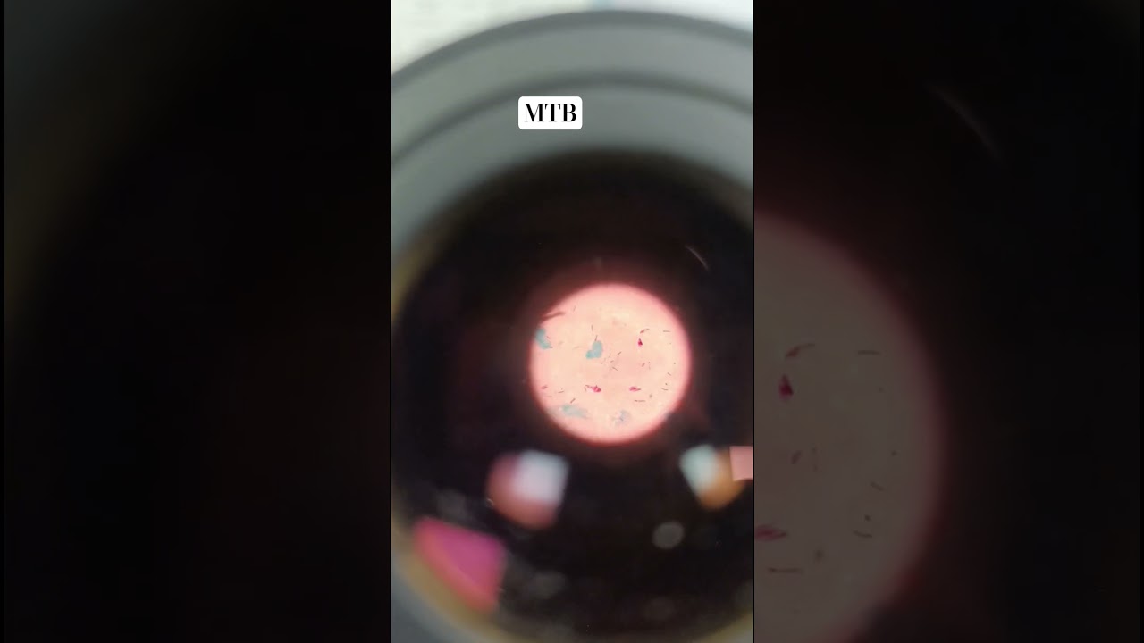Microbacterium Tuberculosis Under Microscope 😲😲
