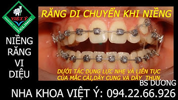 Bạn đã bao giờ thấy răng di chuyển khi niềng răng