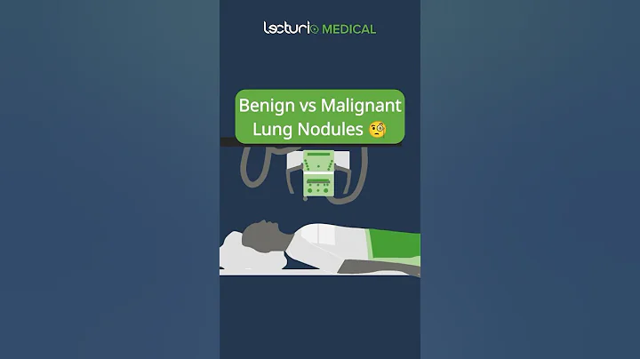 Benign vs Malignant Lung Nodules 🧐 #USMLE #MedicalEducation #Radiology