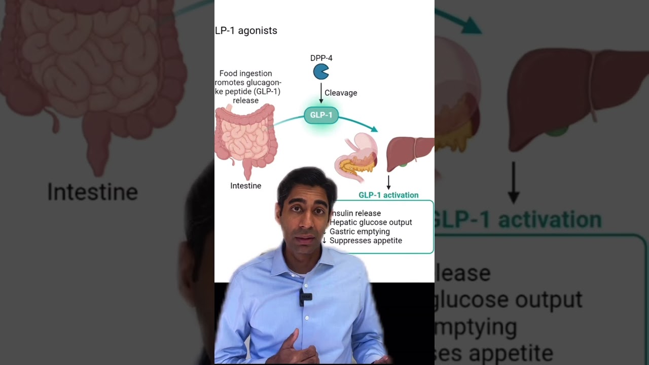 semaglutide bowel obstruction legal team in louisiana ileus gastroparesis law office louisiana semaglutide gastroparesis lawyer Ozempic Lawsuit for Blindness, Stomach Paralysis and Injury Claims michigan semaglutide law  semaglutide gastrointestinal obstruction law firm