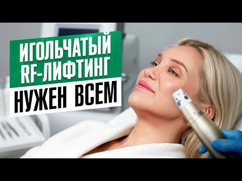 Everyone needs it after 30! The effects of RF needle lifting are shocking.