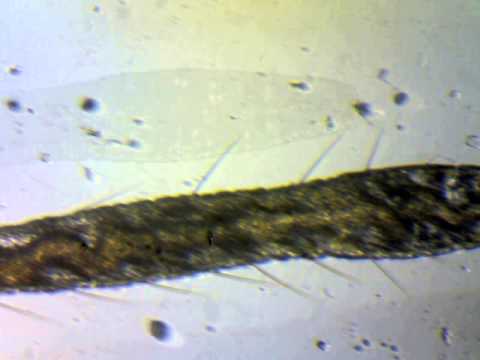 Water Worm - Microscopic Short - YouTube