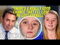 Haylie’s Left Eye Has Been Open for 8 YEARS After Surviving A Near-Fatal Car Crash | Botched | E!