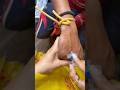Iv Cannulation Process