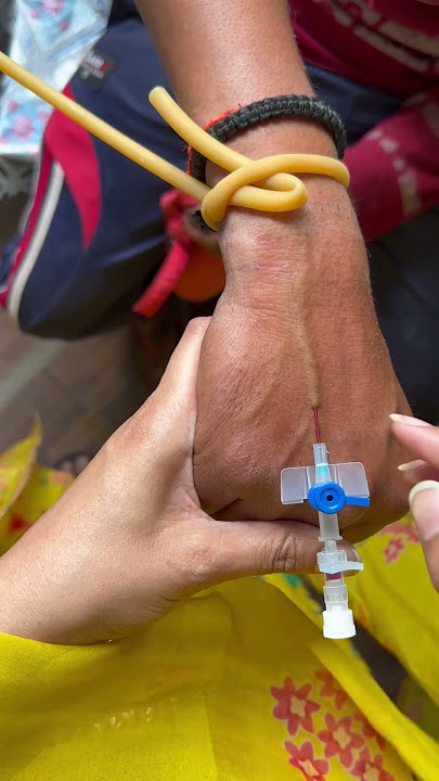 Iv cannulation process