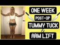 Post-Op Plastic Surgery Week 1! | Tummy Tuck + Arm Lift | Full Body Pictures!