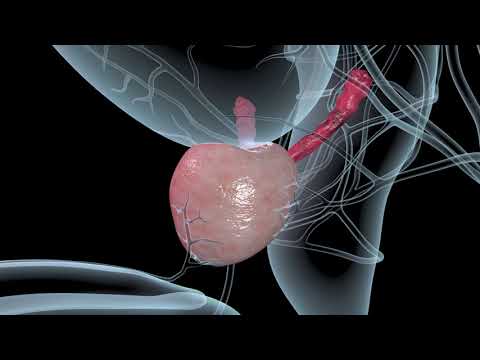 Video: Простата безинин рагына каршы PSA скрининги пайдалуубу?