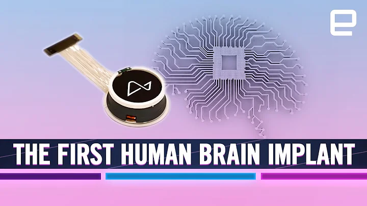 Elon Musk’s Neuralink brain implant: New era of "Brain-Computer Interface" (BCI) technology - DayDayNews