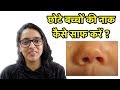 छोटे बच्चों की नाक कैसे साफ करें | Bachchon Ki Naak Kaise Saaf Karein?